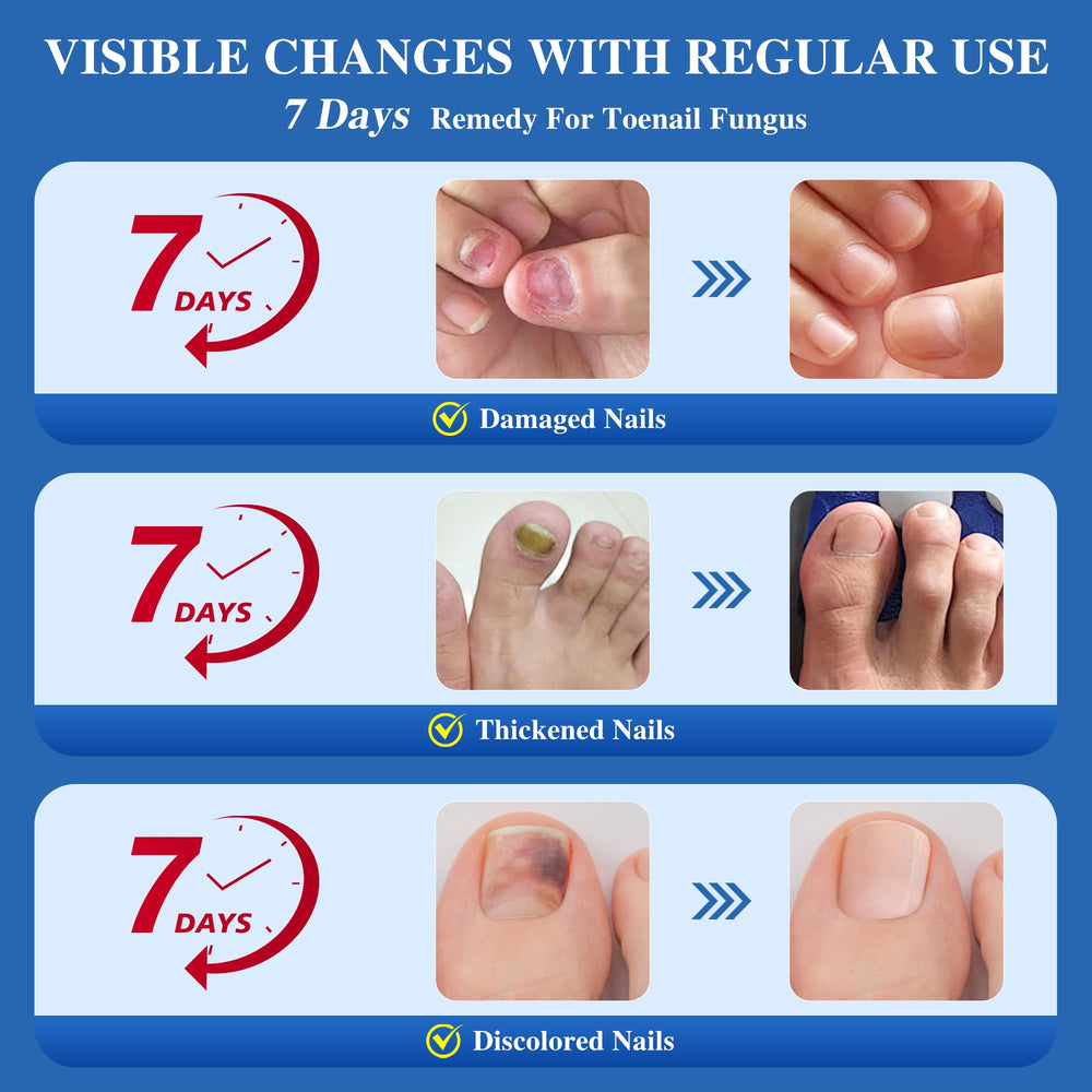 DR.RAPID ingrown nail treatment use demonstrates targeted care