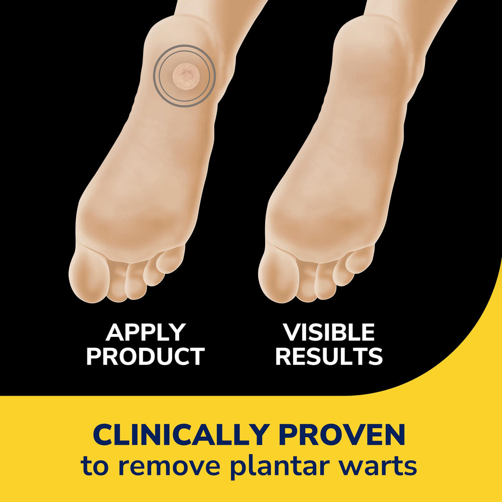 Dr Scholl's Clear Away extra-thick cushioning bandage reduces pressure in daily wear.