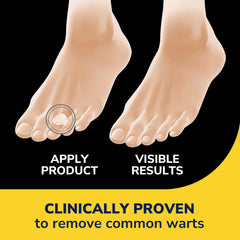 Dr. Scholl's Clear Away bandages being applied for simple wart care
