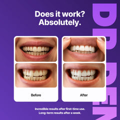 Smiling person showing whiter teeth after using DRDENT