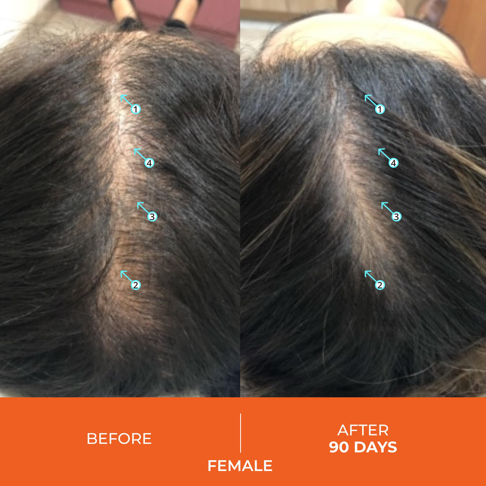 Front view of Revita Hair Vitamin Gummies packaging