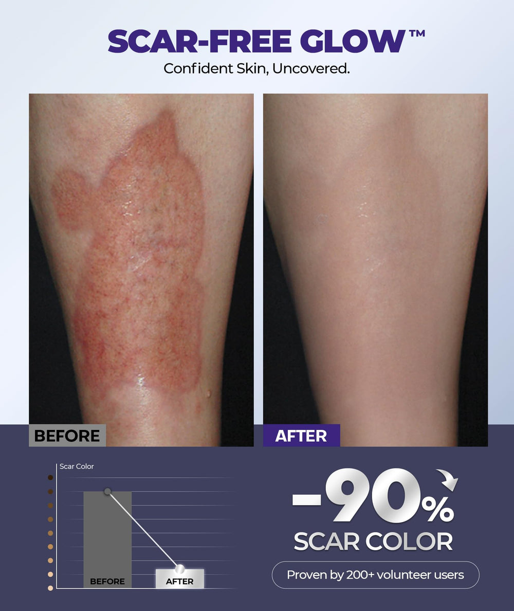 EaseWave scar cream new scar skin visual suggests early improvement potential