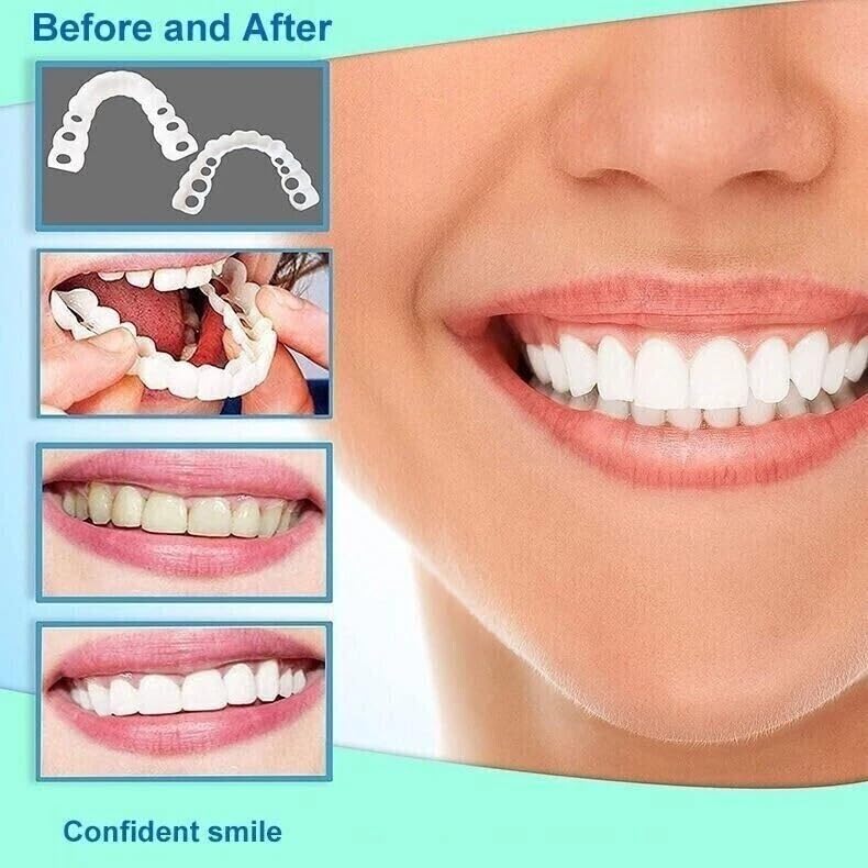 Easy-to-use home smile kit demonstration
