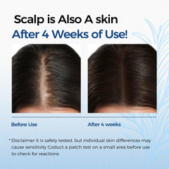 EELEAN roll-on serum applying to thinning areas for scalp care