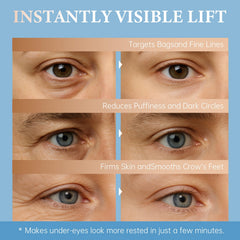 Under-eye area treated for depuff and brighter look