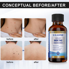 Elsophie visible results-focused design aims for clearer-looking skin