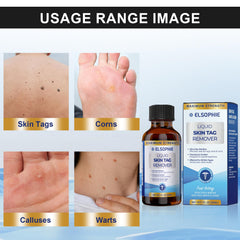 Elsophie salicylic-acid maximum-strength formula supports effective skin tag removal