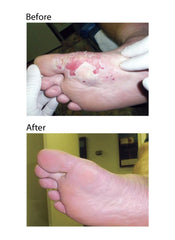 Eras Natural Sciences Wound Honey with Aloe and Panthenol ready for soothing application