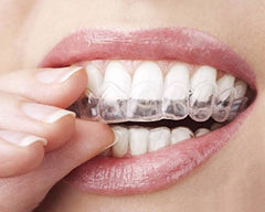 Night guard used to prevent teeth grinding while you rest