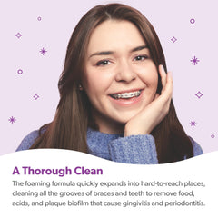 Bacteria-killing mint foam cleans braces and freshens breath