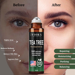 Roll-On applied to skin for blemish care and clarity