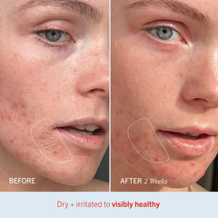 Utilisation visage et corps pour hydratation quotidienne avec Ultra Repair Cream.