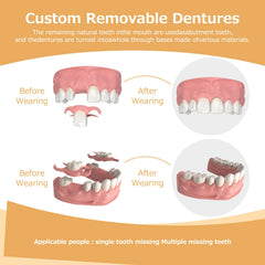 Flexible tooth replacement options (1 to 6)