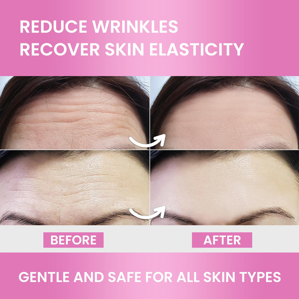 12-piece Forehead Wrinkle Patches pack