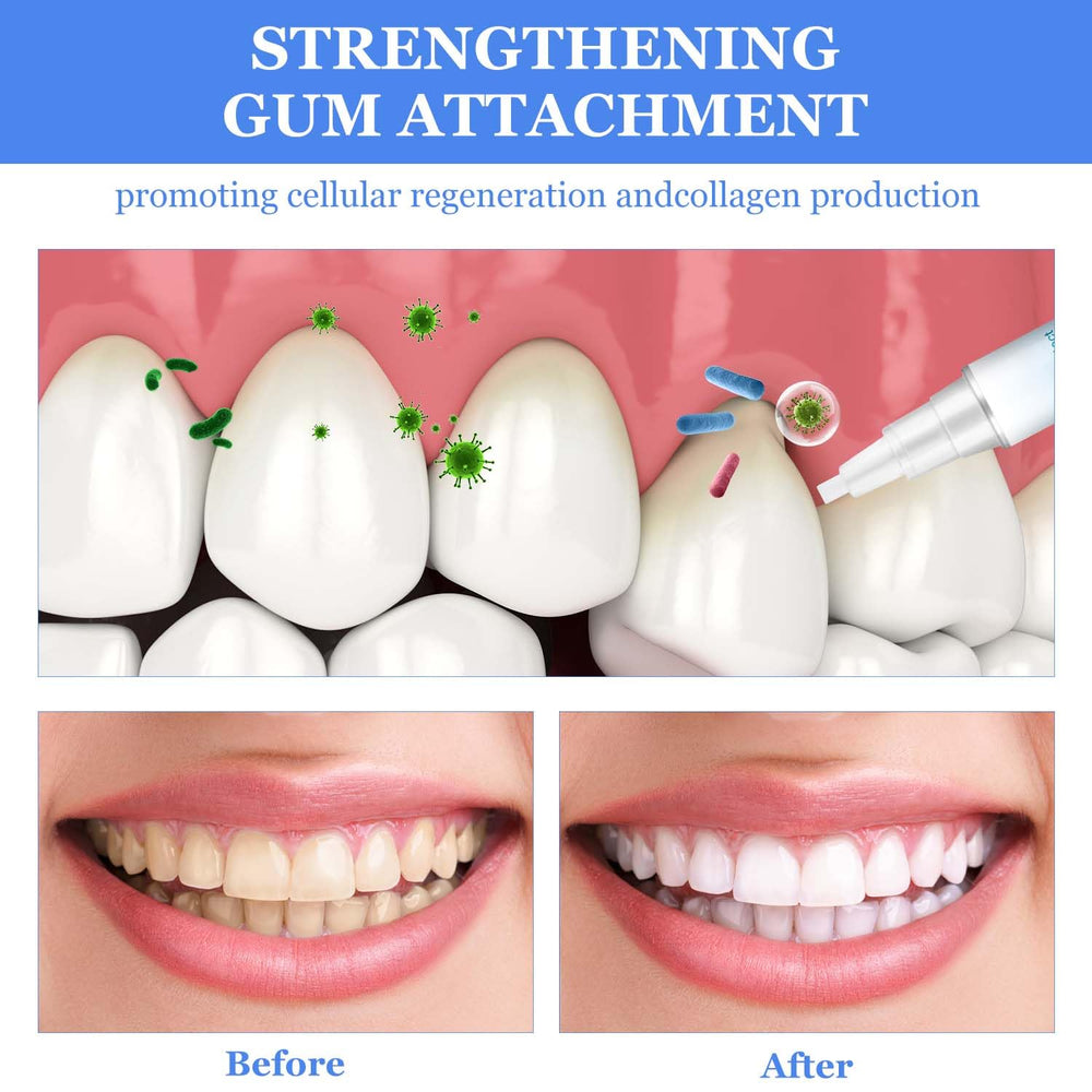 Fresh breath after whitening with Frosty Neptune
