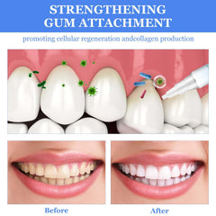 Fresh breath after whitening with Frosty Neptune