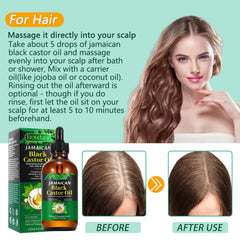 Frovetani Jamaican Black Castor Oil on scalp indicates deep hydration for hair