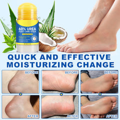 Very dry skin example benefits from Generic Urea 60% Cream Stick