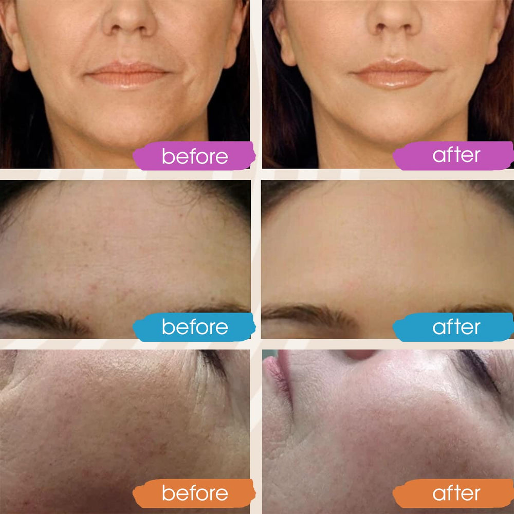 GLEOW Vitamin C Serum being applied to the face for absorption
