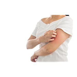 Globe Hydrocortisone Ointment moisture-lock formula on skin surface.