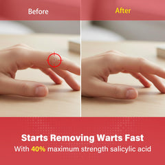Goodnites wart remover pads close-up of the 6-mm patch for small warts