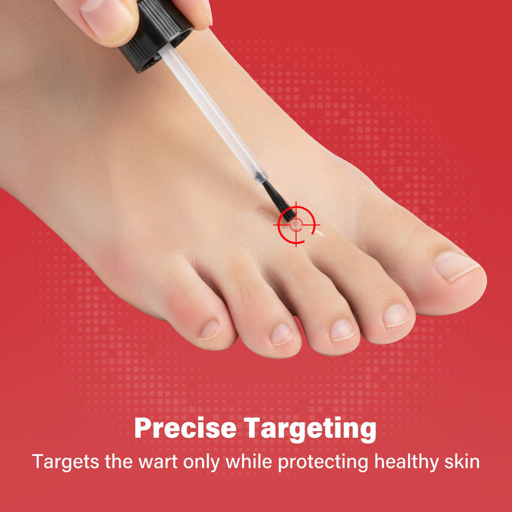 Goodnites wart remover targeting a wart for precise home care.
