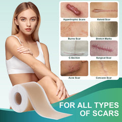 Gowgaw scar tape for day and night wear — discreet under clothing.