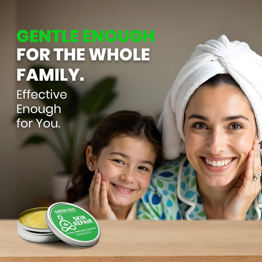 Green Goo skin repair application shows versatile use on dry patches.