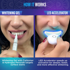 GuruNanda Teeth Whitening Kit with LED Light – product image 3