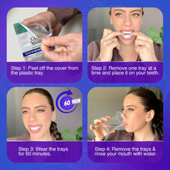 Tray properly fitted on teeth showing a comfortable, secure fit