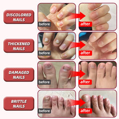 HAIDWEN close-up of nail treatment on brittle nails.