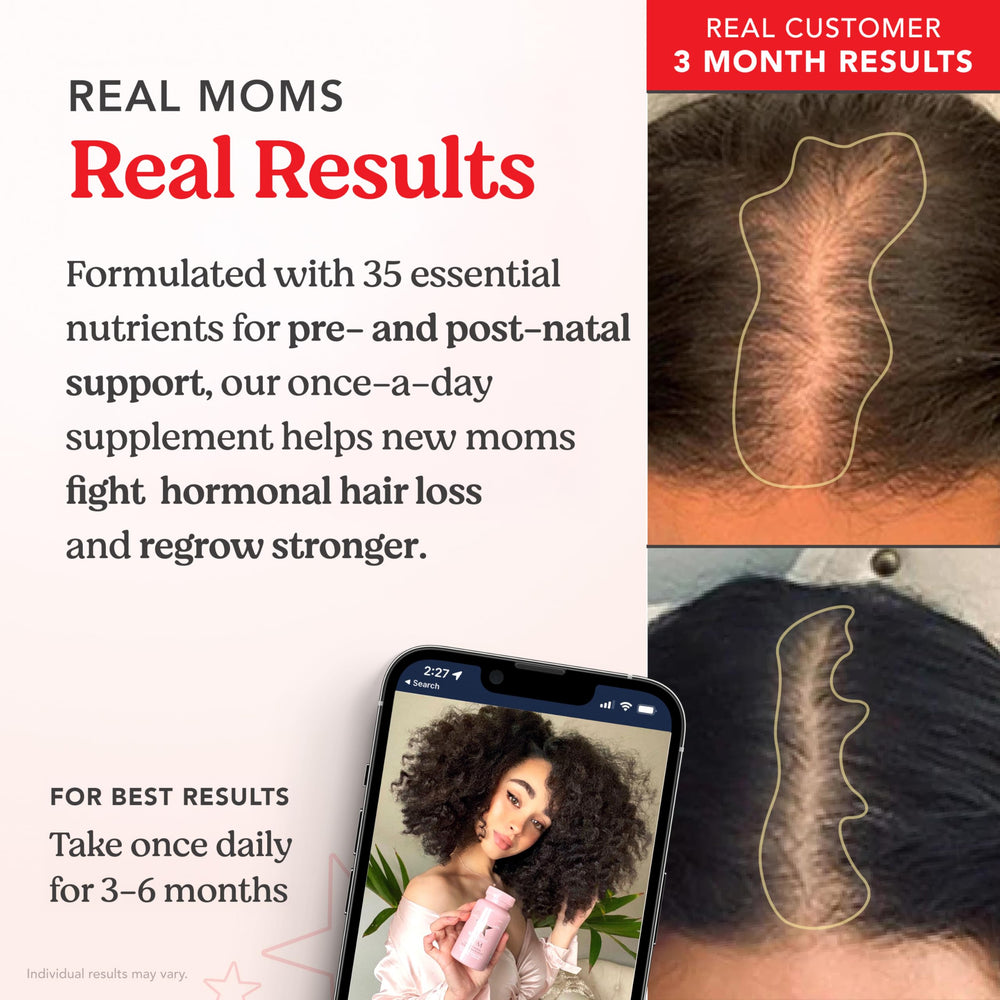 Ingredients: biotin, zinc, iron featured on bottle label