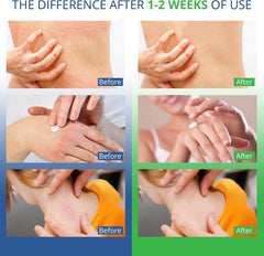 Hermon face-body-use-cream shown for all-over gentle skin care.