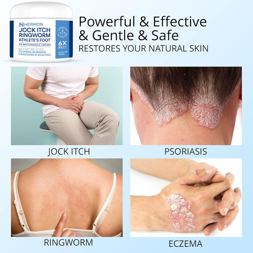 Hermon Ringworm Treatment ointment shows visible improvement while staying non-irritating.