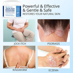 Hermon Ringworm Treatment ointment shows visible improvement while staying non-irritating.