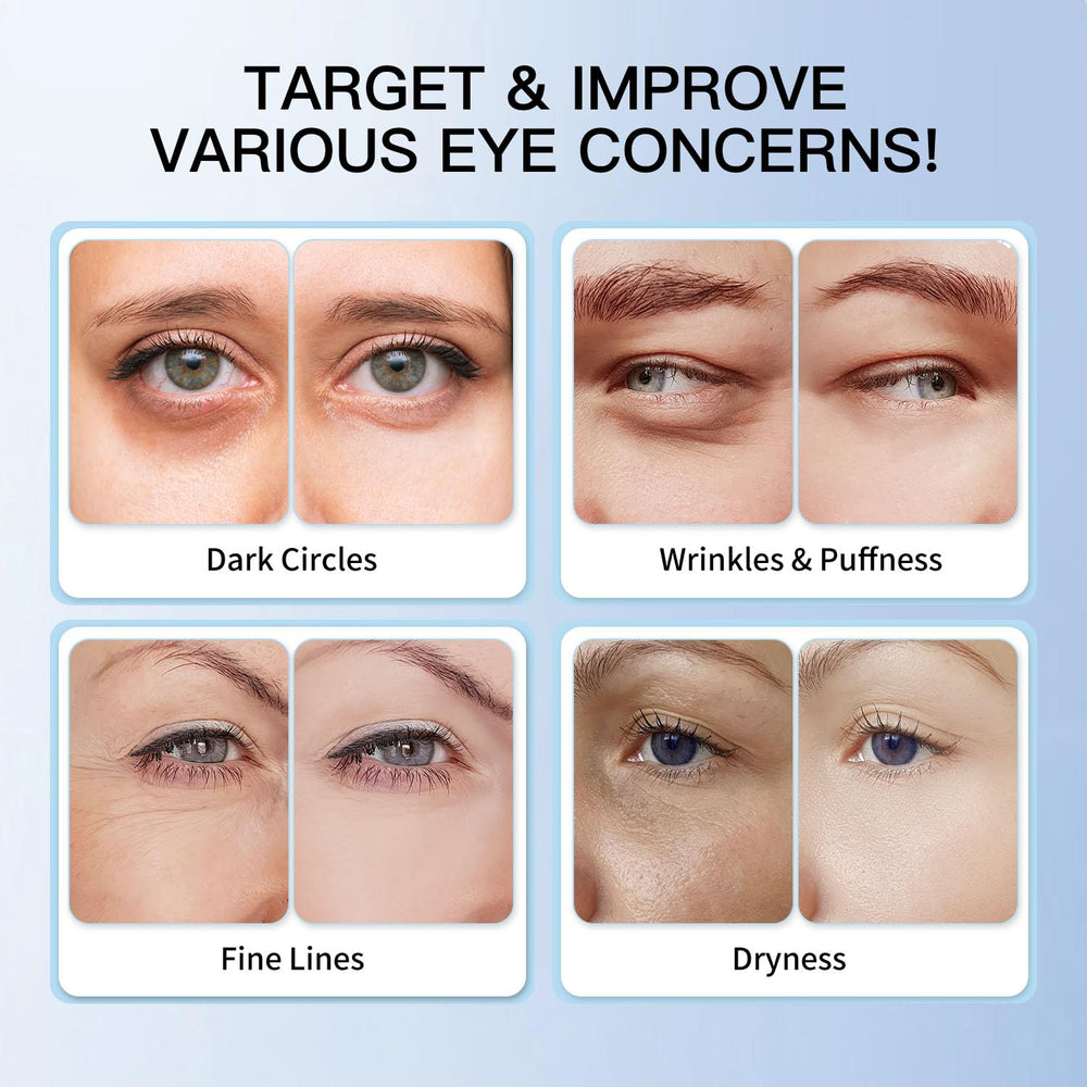 HGTG Eye Serum hydrates and nourishes the under-eye area