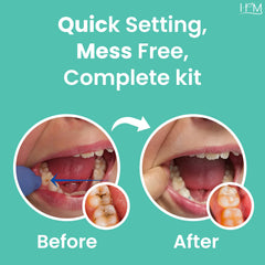 Mouth probe and anti-fog dental mirror