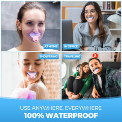 At-home whitening setup using the kit