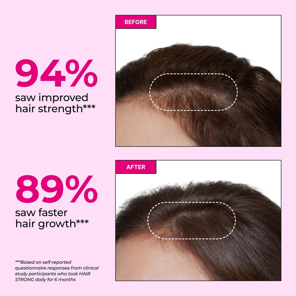 Graphic showing Biotin, Zinc, Folic Acid and B12 ingredients