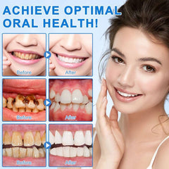 Enamel surface close-up with whitening impression