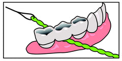 IDontix Brace X-Floss Green product image 4 – green floss close-up