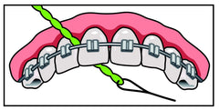 IDontix Brace X-Floss Green product image 7 – packaging and overview