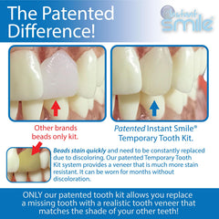 Patented, highly realistic temporary replacement tooth design