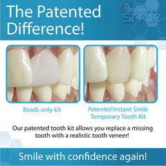 Shaping and trimming tools included with Instant Smile kit