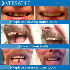 Patented temporary tooth molded in the shape of an actual tooth