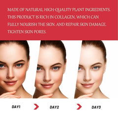 Intimate Area Dark Spot Corrector elbows and knees