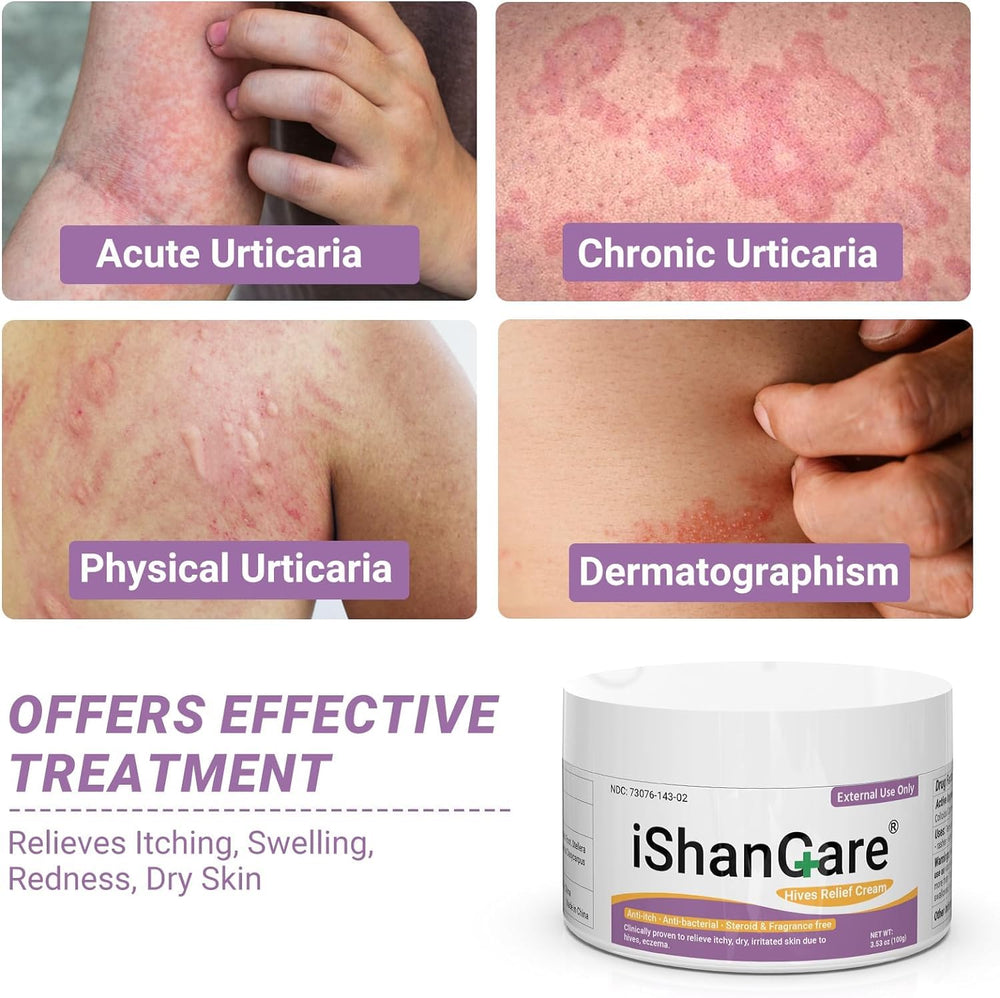 ishancare urticaria cream packaging front highlights natural herbal formula