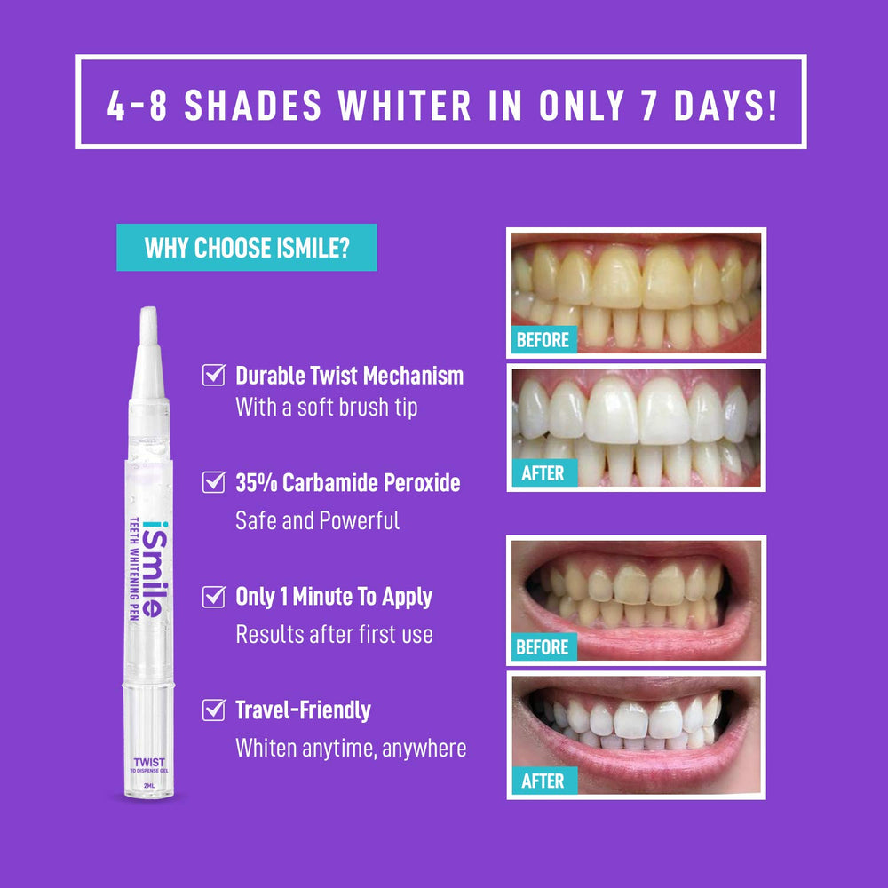 Mint gel and brush tip of iSmile Teeth Whitening Pen