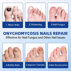JoyJar patch covers the nail surface to help even out texture for a smoother look.