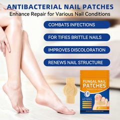 JoyJar patches placed on toenail during night use for restorative care.